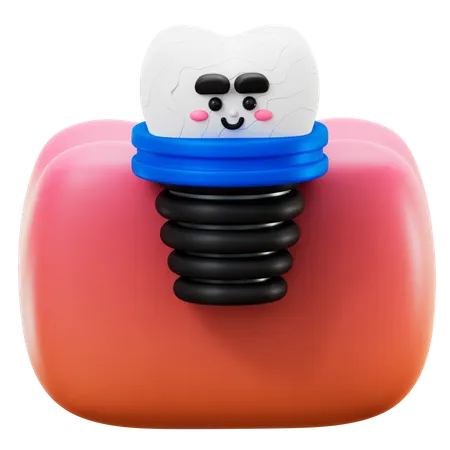 Implante dental  3D Icon