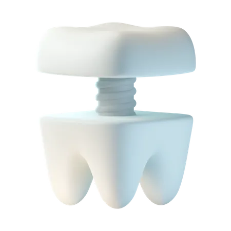 Implante dental  3D Icon