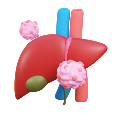 Liver cancer  3D Icon