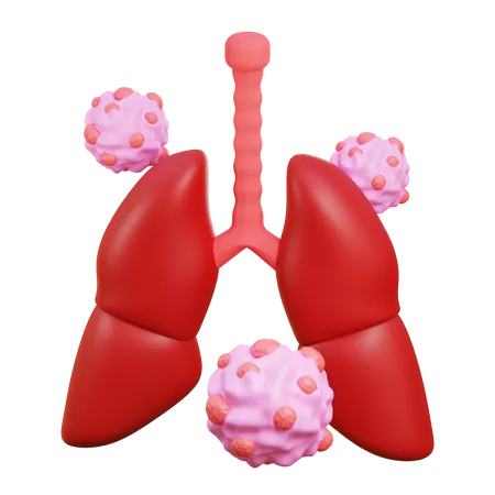 Lung cancer  3D Icon