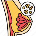 mastitis, breast, anatomy