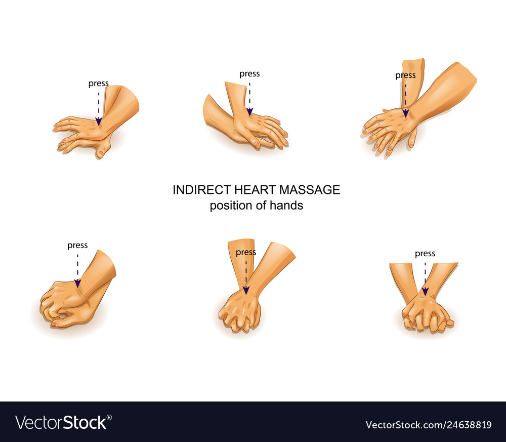 Position of the doctor s hands in indirect heart