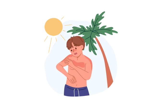 Boy received sunburn due to ultraviolet allergy or heliophobia standing on beach with palm tree  イラスト