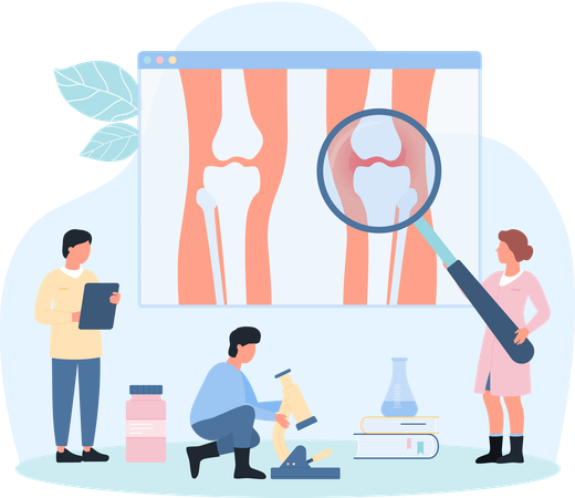 Degenerative cartilage disease in knee joint  Illustration