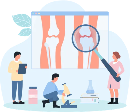 Degenerative cartilage disease in knee joint  Illustration