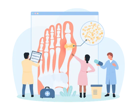 Diagnosis of gout  Illustration