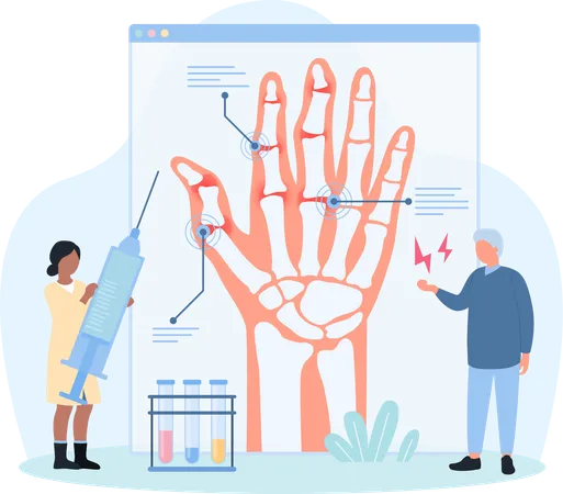 Diagnosis of osteoarthritis  Illustration