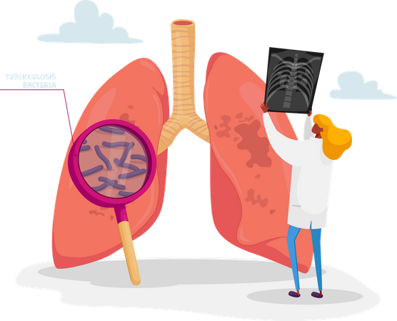 Doctor Holding X-ray Image of Lungs Learning Patient Fluorography with Tuberculosis or Pneumonia Disease  일러스트레이션