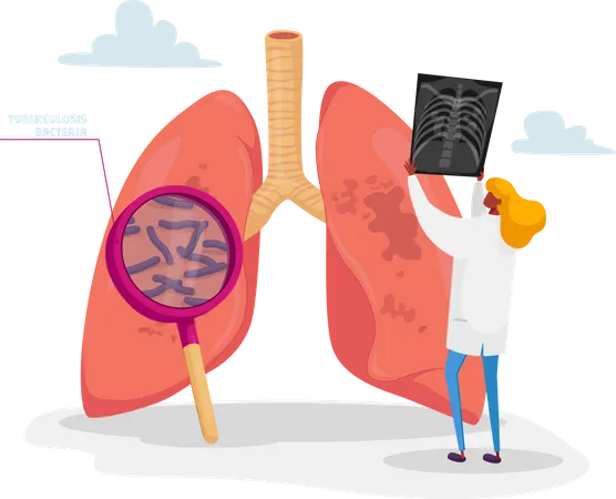 Doctor Holding X-ray Image of Lungs Learning Patient Fluorography with Tuberculosis or Pneumonia Disease  일러스트레이션