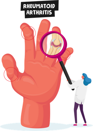 Doctor Looking on Hand with Inflamed Finger Joints Medical Check Up  Illustration