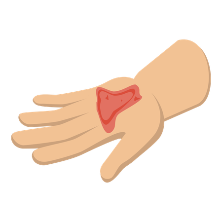 Hand with physical injury  Illustration