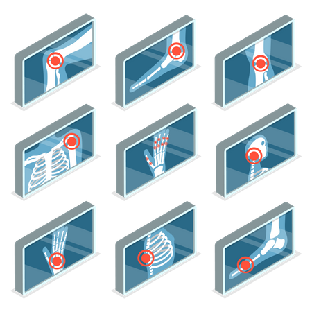 Images of Human Joints  Illustration