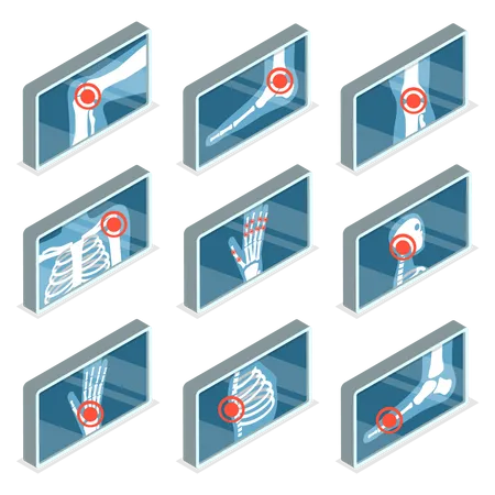 Images of Human Joints  Illustration