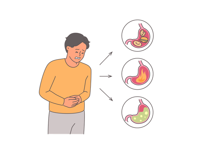 Man suffers from abdominal pain due to stomach problems and needs help of gastroenterologist  Illustration