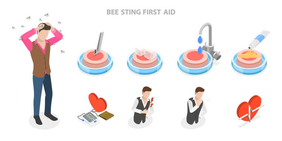 Premiers soins en cas de piqûre d'abeille  Illustration