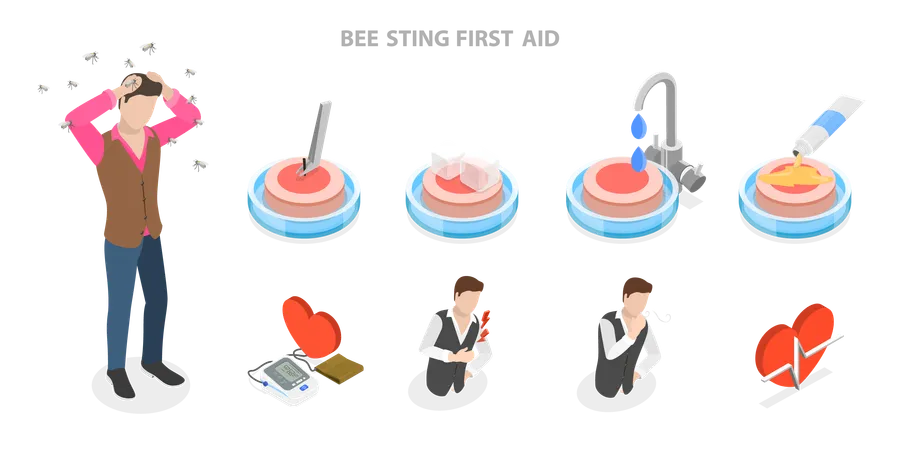 Premiers soins en cas de piqûre d'abeille  Illustration