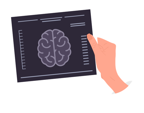 Mano que sostiene el resultado de la resonancia magnética del cerebro  Ilustración