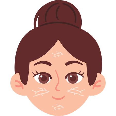 Woman with Dry Skin  Illustration