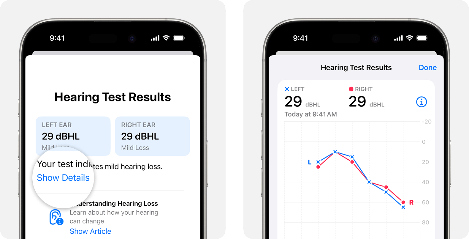 Detailed results of a hearing test taken with AirPods Pro 2 on iPhone.