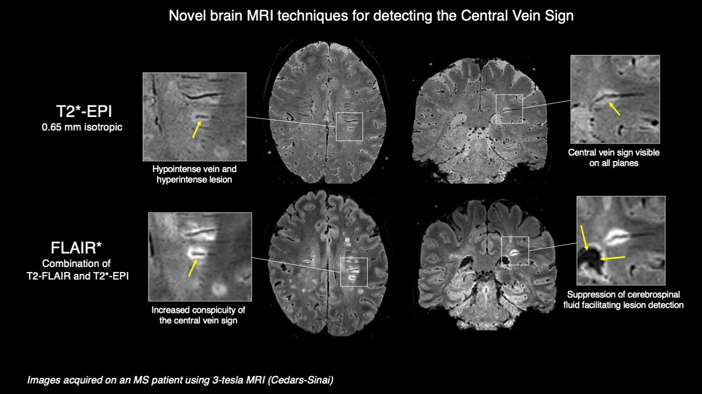 Brain Scan