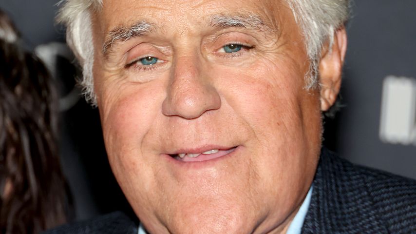 Wie geht es Jay Leno nach schwerem Brandunfall mittlerweile?