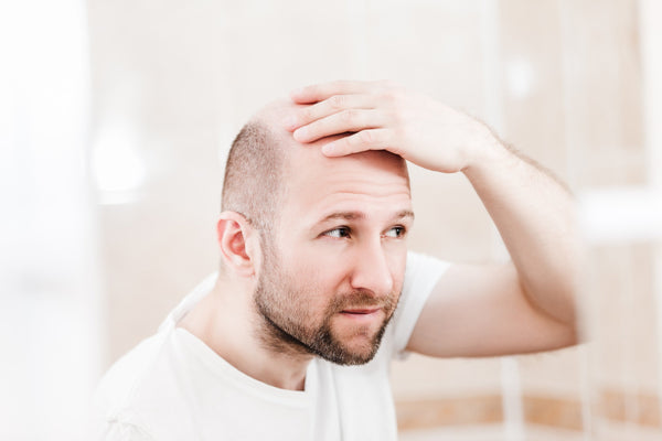 Aging man notices hair loss 