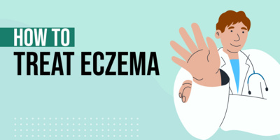 Hot to Treat Eczema: 9 Ways to Clear up Eczema