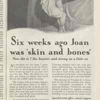 Ad, Cocomalt: "Six weeks ago Joan was "skin and bones" By R.B. Davis Co., Hoboken; in LHJ, May 1931.