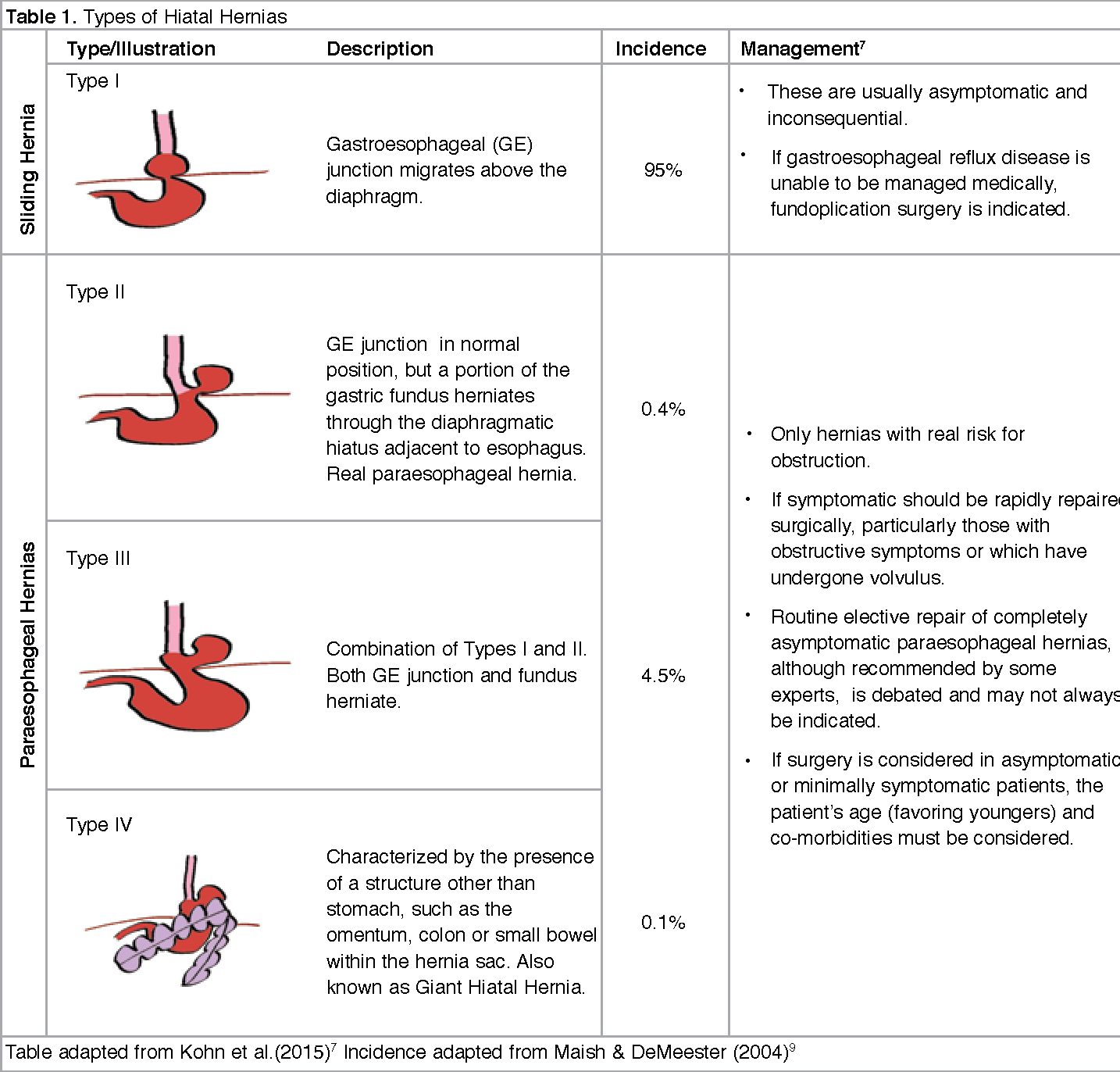 Paraesophageal Hernia Types