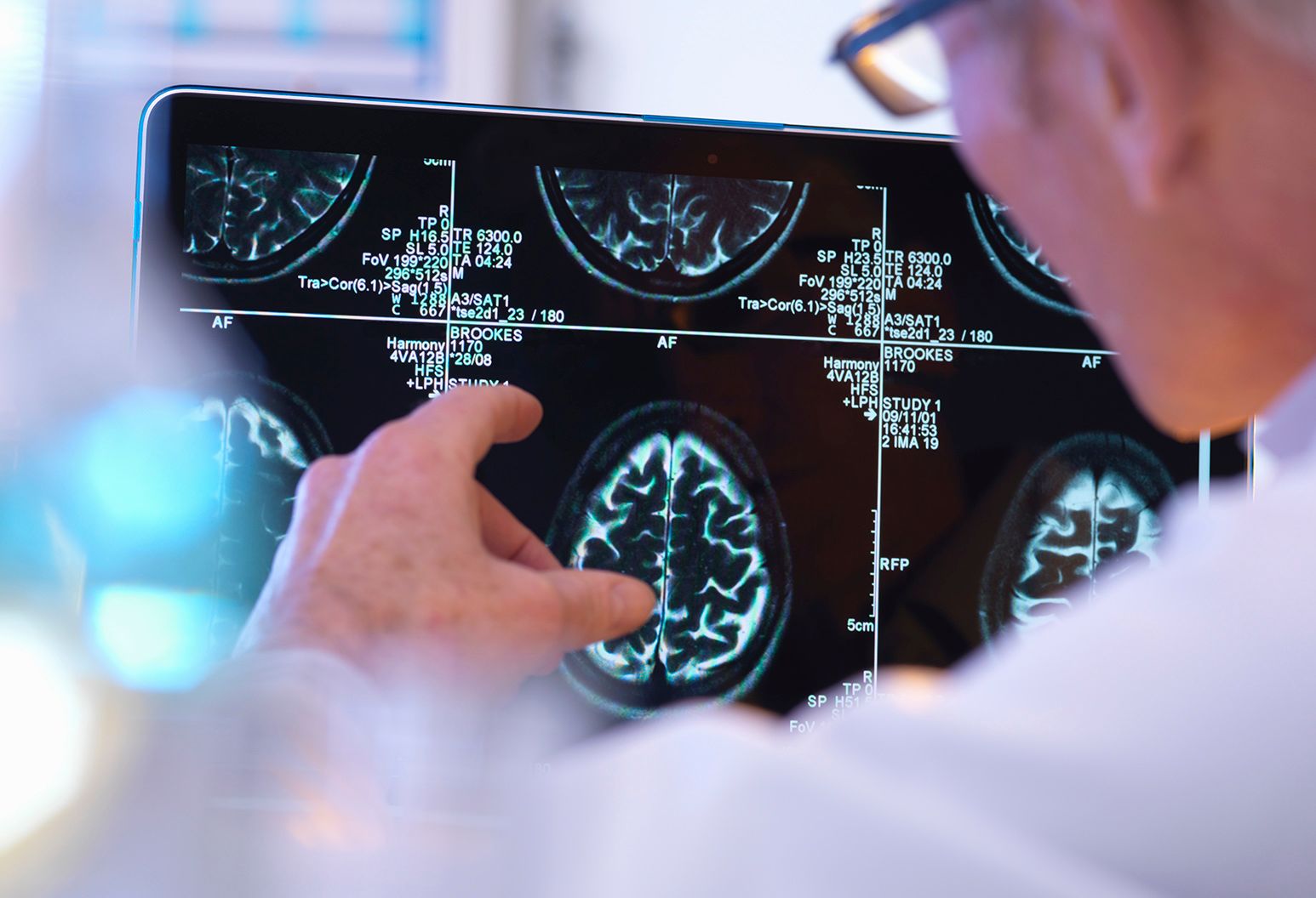 Male radiologist reviews digital brain images on monitor