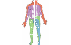 IPAP 16 1 Dermatome Map PurposeGames