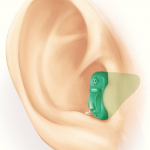 Completely in canal hearing aids