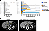 Clinical outcome and antileukemic response duration.