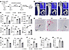 CST6 protein inhibits bone destruction in 5TGM1-C57BL/KaLwRij MM mice.