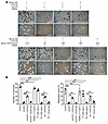 CST6 protein inhibits osteoclast differentiation and function.