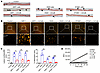 CST6 protein inhibits MM cell–induced bone resorption and CTSK activity.