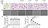 CST6 protein suppresses bone-resorptive activity of mature osteoclasts.