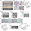 CST6 protein suppresses CTSL-induced proteolytic cleavages of p100 and TRAF