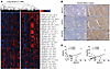 BACH1 expression correlates with angiogenesis gene and protein expression i