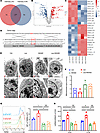 Lactate promotes Treg metabolism by GRN N-glycosylation.