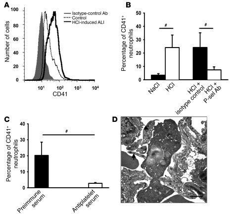 Acid-induced ALI causes platelet-neutrophil interactions.
(A) Flow cytom...