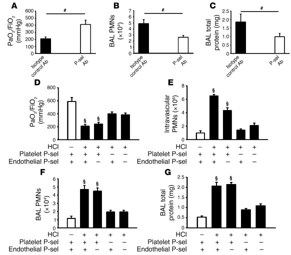 Platelet P-selectin plays key role in the development of ALI.
(A–C) Inje...