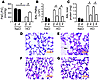 Platelets control PMN recruitment into the lung in acid-induced ALI.