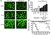 Endothelial cell response to TP activation as reflected by F-actin localiza