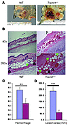 Targeted deletion of Treml1–/– results in increased hemorrhage associated w