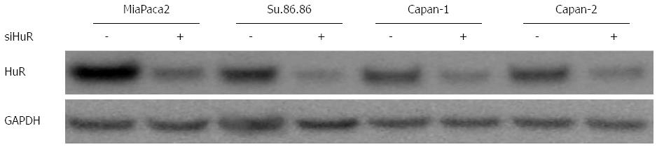 HuR mediated post-transcriptional regulation as a new potential ...