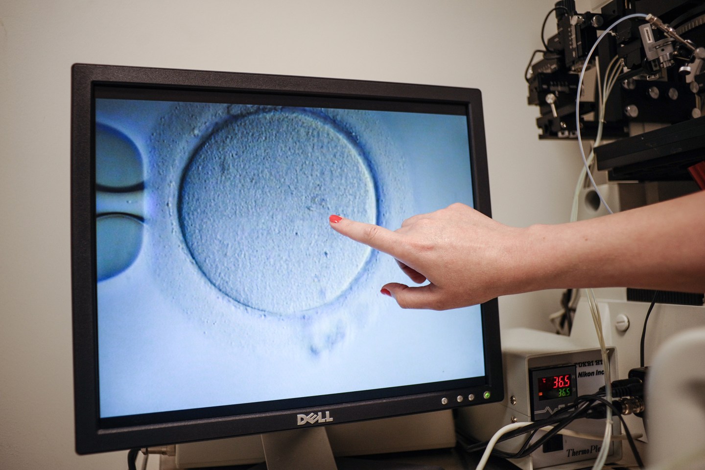 An embryologist points to an Ovocyte after it was inseminated at the Virginia Center for Reproductive Medicine, in Reston, Virginia.