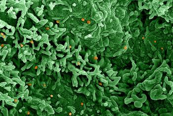 The mpox virus (orange) infects cells depicted in green.