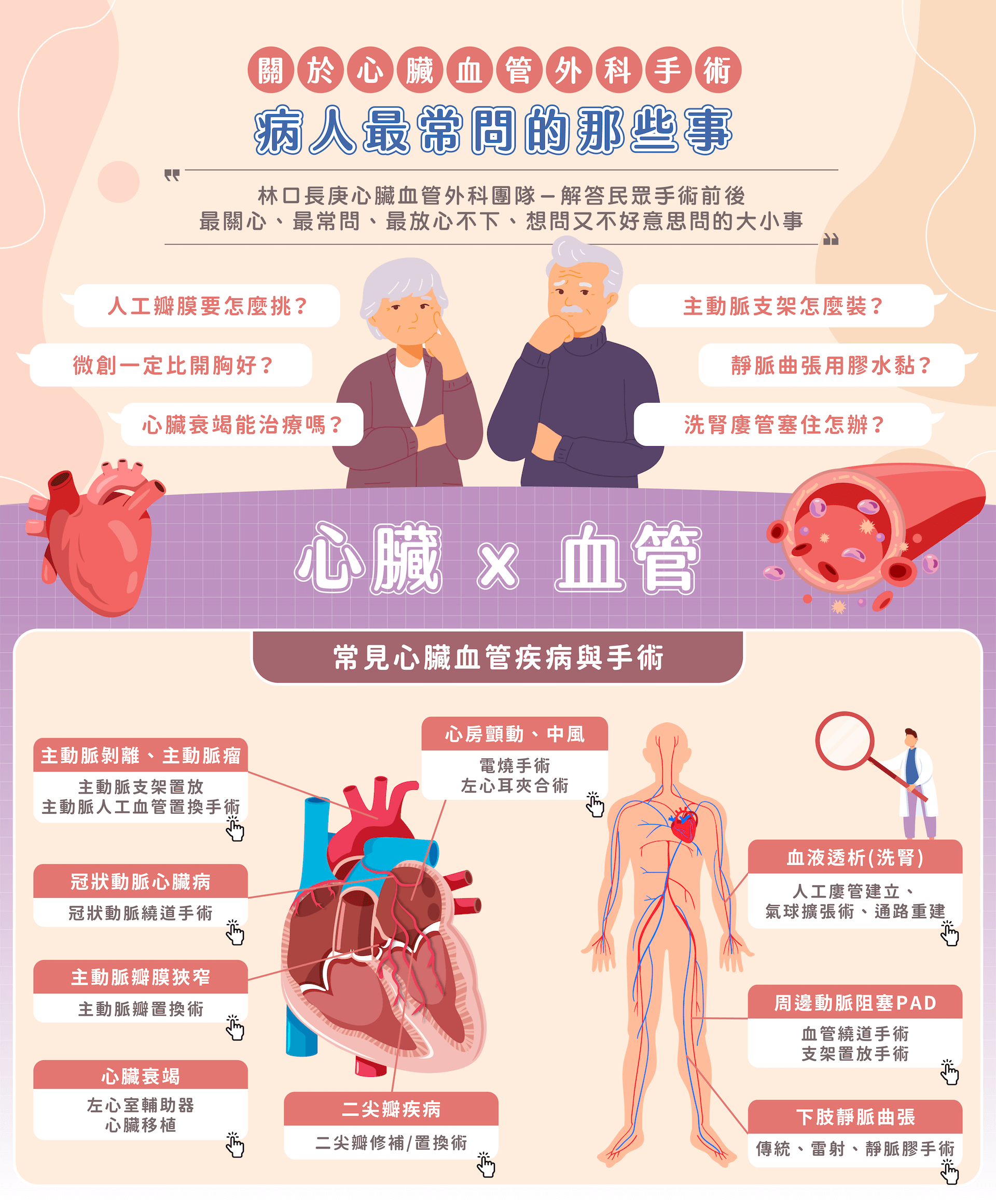 心臟血管外科手術