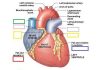 Pictures Of Atrial Appendage (auricle)